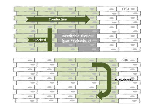 Reentry circuit diagram